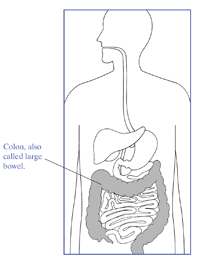 Illustration of a bowel.