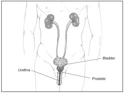 Drawing of the male urinary tract with prostate, urethra, and bladder labeled.