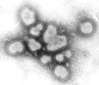 Microscope photo of the influenza A virus