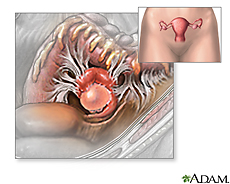 Diagram of the ovaries